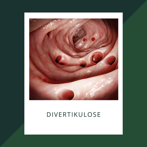 Diätologie Brunnmayr - Blog Divertikulose